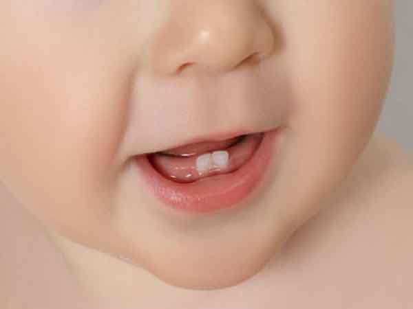 Mộng thấy răng sâu không phải là điều tốt trong cuộc sống thực