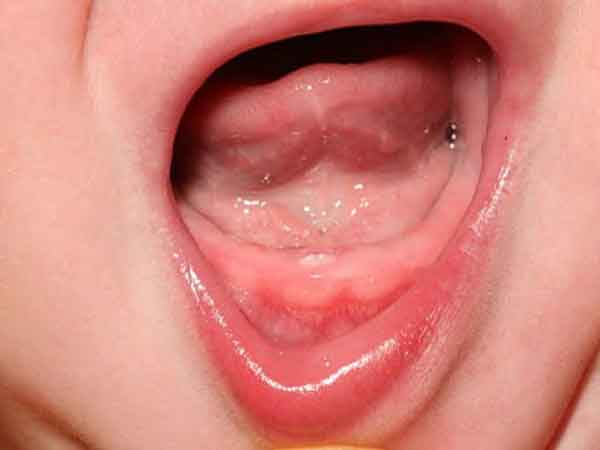 Mơ thấy con gái mình mọc răng phát sốt dự báo điều gì?